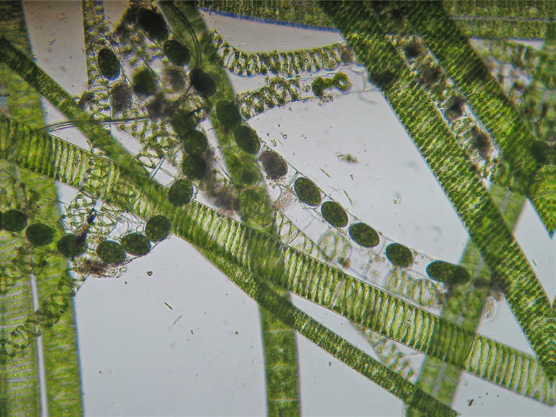 Coniugazione di Spirogyra
